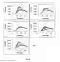 Fig. 17 - METHOD AND DEVICE FOR MEASURING COAGULATION IN A SAMPLE OF A BLOOD PRODUCT