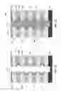 Fig. 07 - Three-dimensional charge trapping NAND cell with discrete charge trapping film