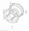 Fig. 02 - METHOD OF REMANUFACTURING A WHEEL HOUSING