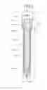 Fig. 04 - Spark plug with center electrode for internal combustion engine