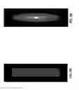 Fig. 04 - Sampling strategies for sparse magnetic resonance image reconstruction