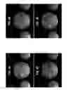 Fig. 06 - Sampling strategies for sparse magnetic resonance image reconstruction