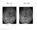Fig. 09 - Magnetic resonance imaging apparatus and method