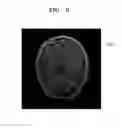 Fig. 11 - Magnetic resonance imaging apparatus and method