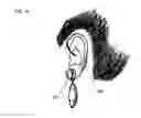 Fig. 07 - Earring Hearing Aid
