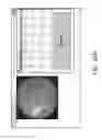 Fig. 49 - Systems and methods for processing retinal images for screening of diseases or abnormalities
