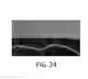 Fig. 32 - Systems and methods for automatically generating descriptions of retinal images