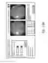 Fig. 37 - Systems and methods for automatically generating descriptions of retinal images
