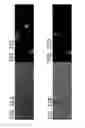 Fig. 41 - Systems and methods for automatically generating descriptions of retinal images