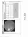 Fig. 49 - Systems and methods for automatically generating descriptions of retinal images