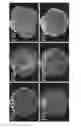 Fig. 53 - Systems and methods for automatically generating descriptions of retinal images