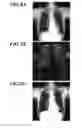 Fig. 08 - Medical image processing apparatus and computer-readable storage medium