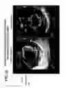 Fig. 43 - THREE-DIMENSIONAL TISSUE STRUCTURE