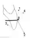 Fig. 01 - Orthodontics system and method of use