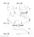 Fig. 02 - Orthodontics system and method of use