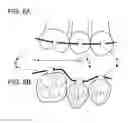 Fig. 08 - Orthodontics system and method of use