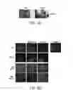 Fig. 06 - METHODS AND COMPOSITIONS FOR MODULATING TUMOR CELL ACTIVITY