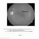 Fig. 02 - OPTICAL REGULATION OF GENE EXPRESSION IN THE RETINA