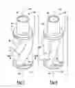 Fig. 07 - Cell washing device using a wave