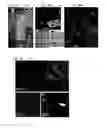 Fig. 02 - CELLULAR APOBEC3 PROTEINS AND MODULATORS THEREOF FOR REGULATING DNA REPAIR PROCESSES AND TREATING PROLIFERATIVE DISEASES