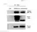Fig. 06 - Method for treating glioma using Tarbp2 expression inhibitor