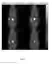 Fig. 07 - Small peptide specific for lung cancer and application thereof
