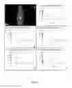 Fig. 09 - Small peptide specific for lung cancer and application thereof