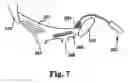 Fig. 08 - Surgical articles and methods for treating pelvic conditions
