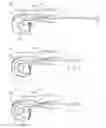 Fig. 01 - Fertilized egg or sperm injector