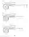 Fig. 02 - Fertilized egg or sperm injector