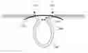 Fig. 01 - Diverticulum treating device