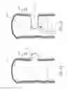 Fig. 02 - Diverticulum treating device