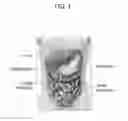 Fig. 02 - Soft bladder for interabdominal surgery