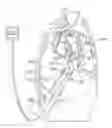 Fig. 01 - DIAPHRAGM ENTRY FOR POSTERIOR SURGICAL ACCESS