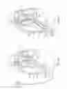 Fig. 04 - DIAPHRAGM ENTRY FOR POSTERIOR SURGICAL ACCESS