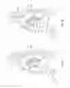 Fig. 07 - DIAPHRAGM ENTRY FOR POSTERIOR SURGICAL ACCESS