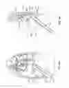 Fig. 09 - DIAPHRAGM ENTRY FOR POSTERIOR SURGICAL ACCESS