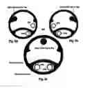 Fig. 06 - Devices, systems and methods for detecting a bilateral differential in olfactory threshold for pure odorants