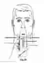 Fig. 22 - Devices, systems and methods for detecting a bilateral differential in olfactory threshold for pure odorants