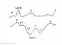 Fig. 22 - Compositions and methods for measurement of oxygen saturation in blood filled structures