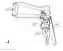Fig. 01 - Optical speculum