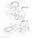 Fig. 02 - Method and apparatus for providing a dynamically loaded force and/or a static progressive force to a joint of a patient