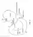 Fig. 02 - Methods of treatment using a bariatric sleeve