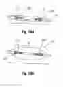 Fig. 09 - BALLOON CATHETER WITH EXPANDABLE SHAFT