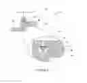 Fig. 03 - Wearable external ventricular drain system