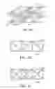 Fig. 07 - Negative pressure wound closure device