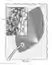 Fig. 12 - Negative pressure wound closure device