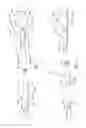 Fig. 02 - DUAL RAPID EXCHANGE CATHETERS, SYSTEMS, AND METHODS