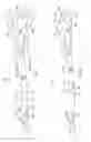 Fig. 02 - DUAL RAPID EXCHANGE CATHETERS, SYSTEMS, AND METHODS