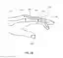 Fig. 03 - DEVICES FOR BONE FIXATION USING AN INTRAMEDULLARY FIXATION IMPLANT